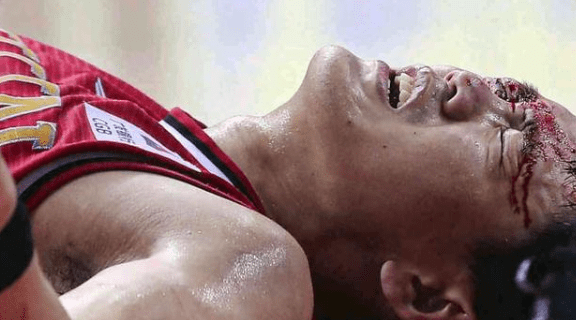 包含江苏队遭遇重创，主力球员受伤的词条